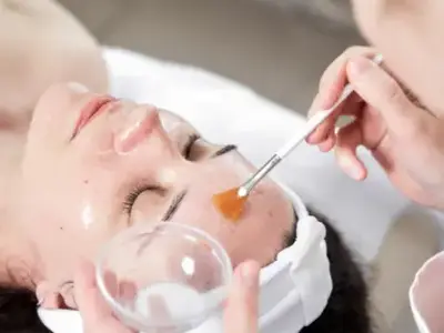 Best chemical peel treatment in Dermyzz SKin CLinic in Mumbai's Andheri areas